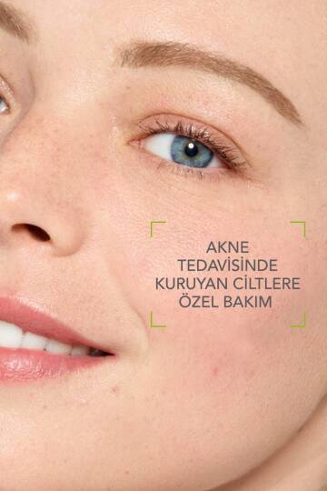 Bioderma Sebium İzokit+ Kurutucu Akne Tedavisine Destek Cilt Bakım Kiti - 4