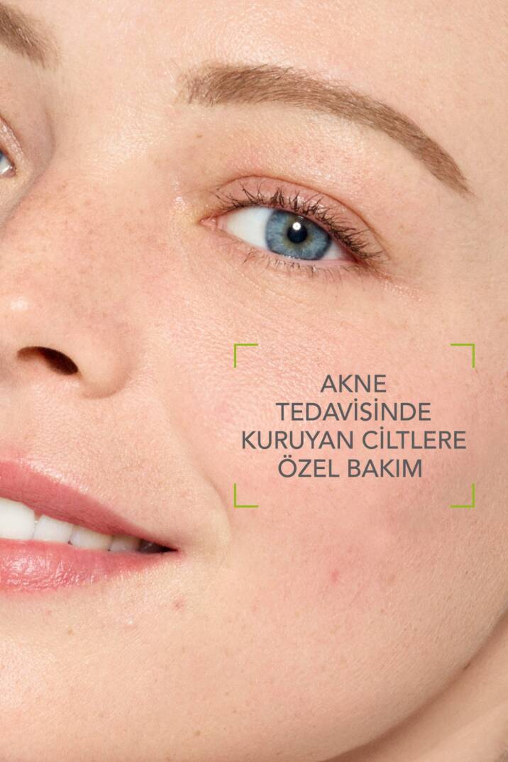Bioderma Sebium İzokit+ Kurutucu Akne Tedavisine Destek Cilt Bakım Kiti - 4