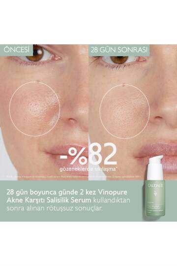 Caudalie Vinopure Serum 30 ml - 3