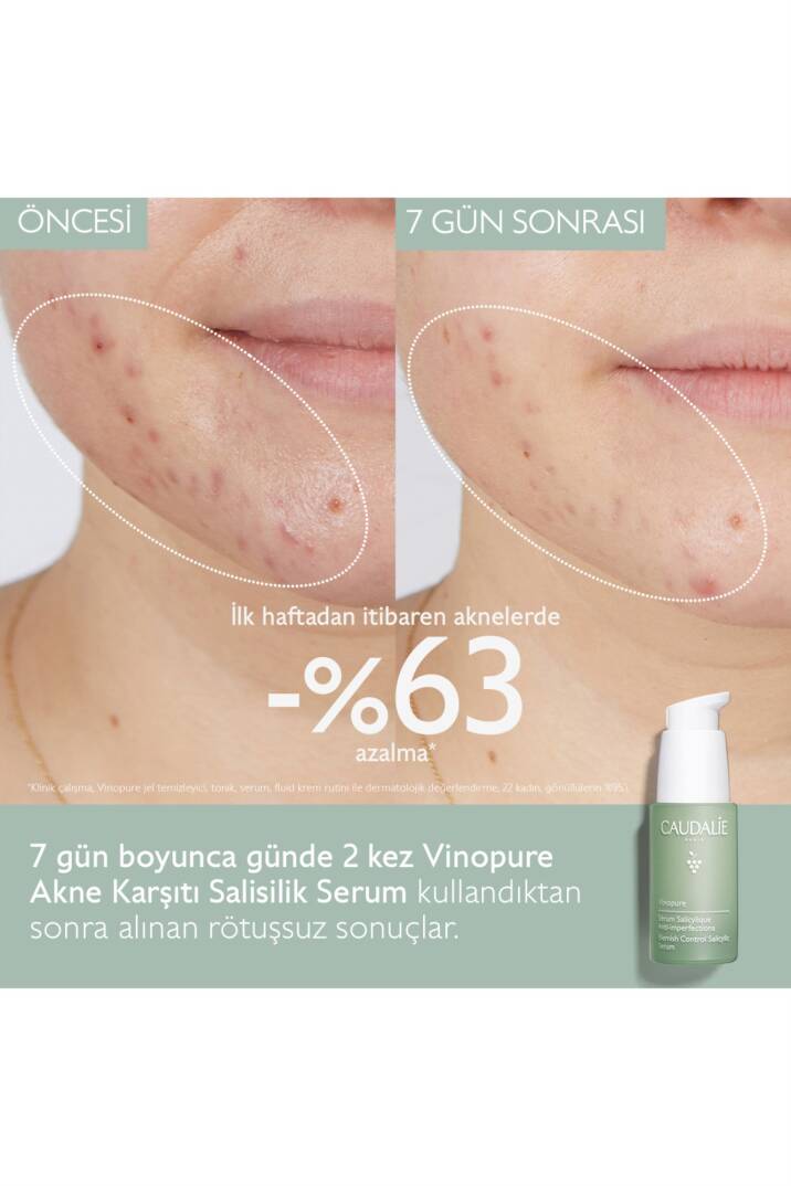 Caudalie Vinopure Serum 30 ml - 5