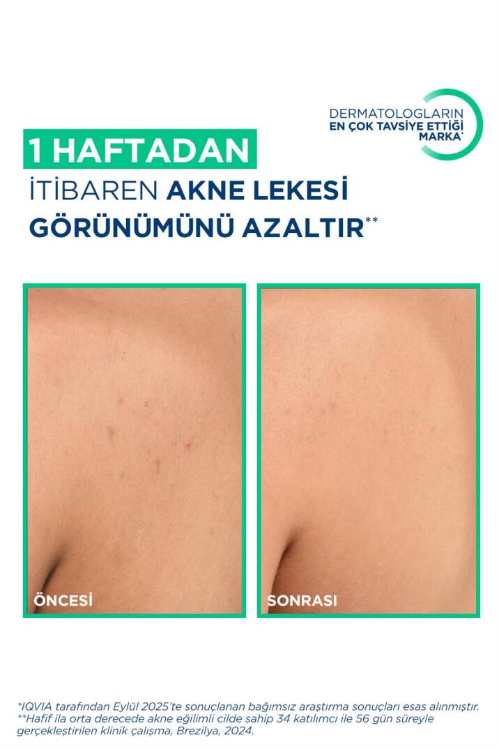 Sebium Kerato+ Body Sivilce, Akne Lekesi Karşıtı Salisilik Asit Niasinamid İçeren Vücut Spreyi 150ml - 2